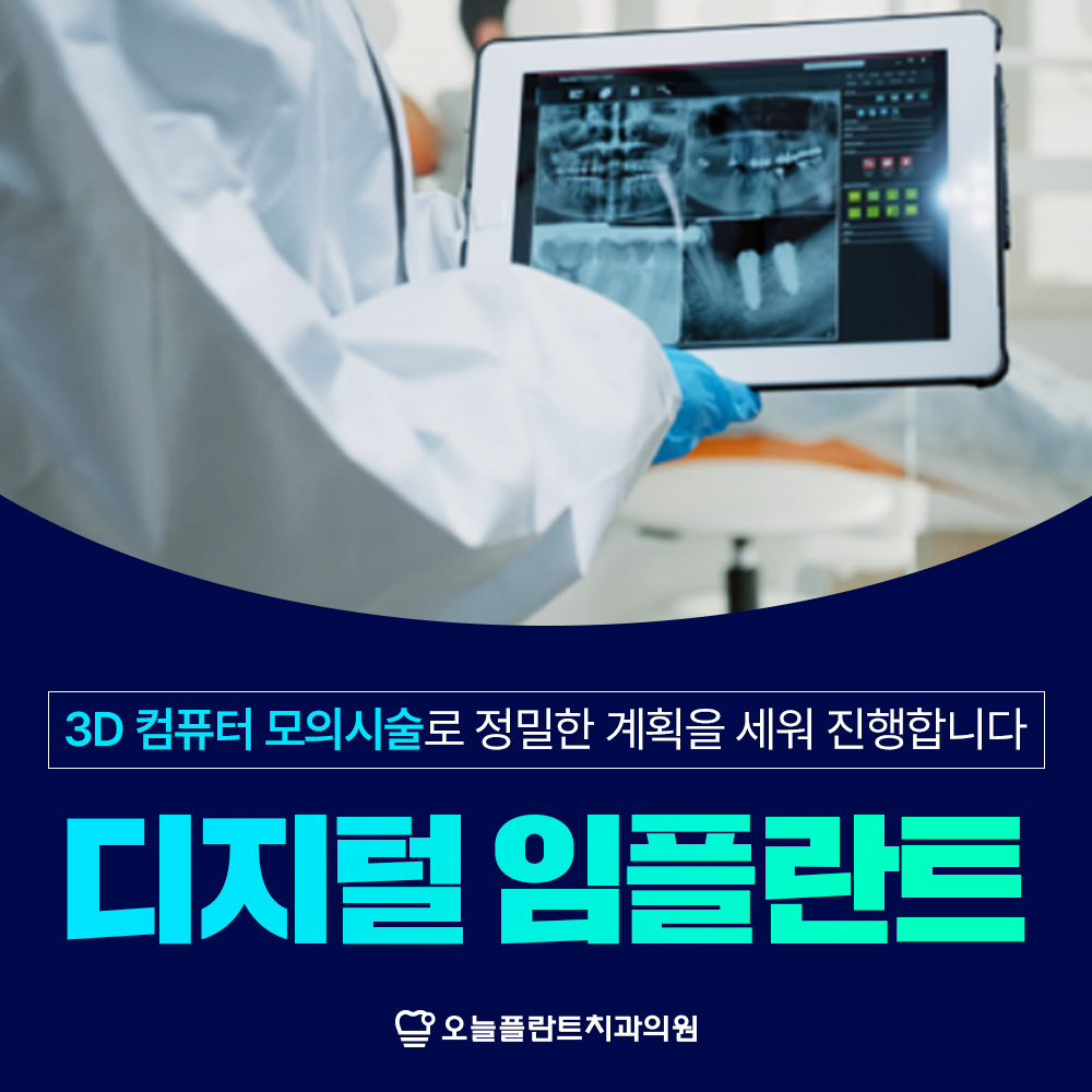 오늘플란트치과의 임플란트