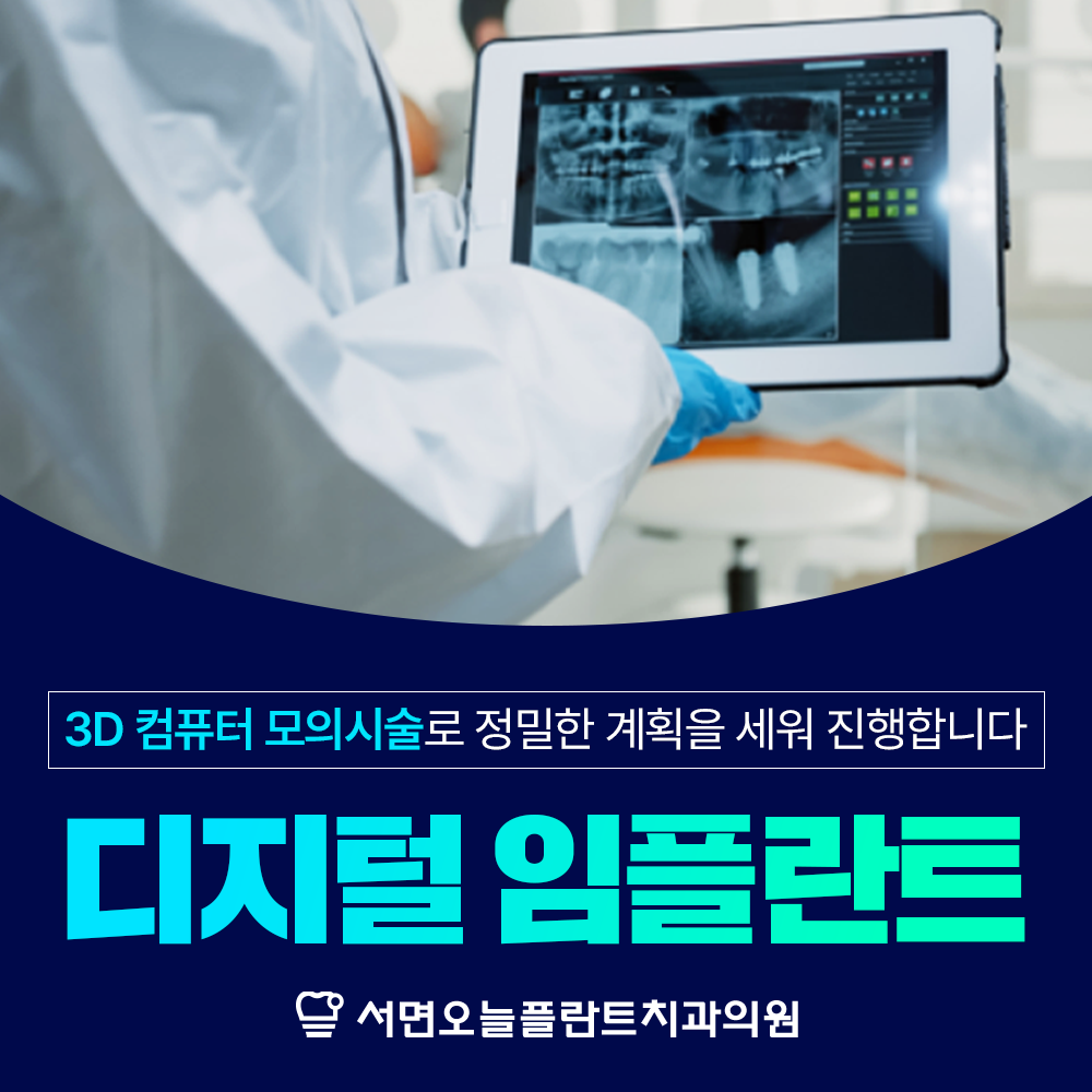 오늘플란트치과의 임플란트